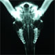 Rectal X-ray