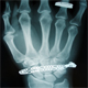 Hand X-ray