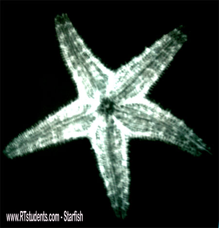 Star Fish X-ray